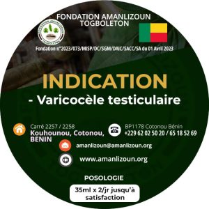 Varicocele